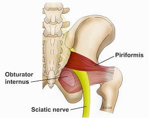 piriformis, piriformis syndrome, ostepathy, ostepath, nelson, bc