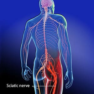 Sciatic nerve, sciatica, nerve pain, osteoapthy, osteopath, Nelson, bc